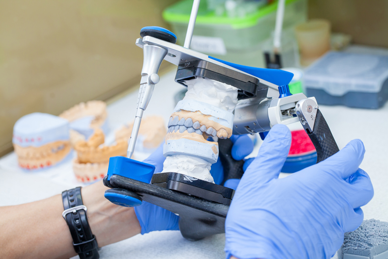 How Many Dental Implants Are Needed For A Full Mouth Dental Implant Procedure?
